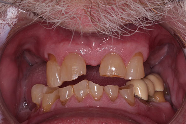 Smile Gallery - Before