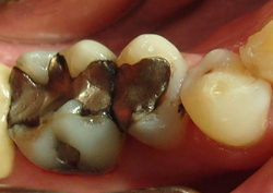 Smile Gallery - Before